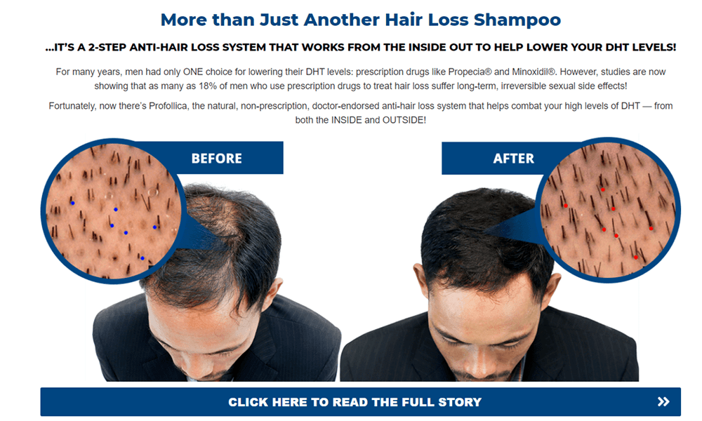 Hair Growth For Male