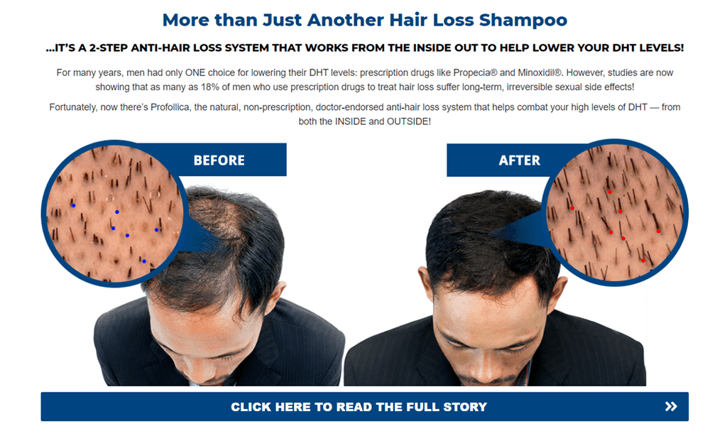 Profollica Hair Growth For Male Ecuador Quito